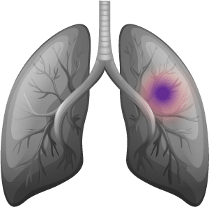 LUNG-icon2 LUNG-icon2